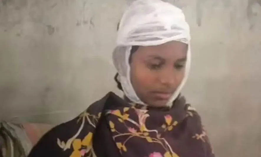 ডাস্টার দিয়ে ছাত্রীর মাথা ফাটালেন প্রধান শিক্ষক